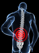 Boston Spinal Cord Injury Litigation